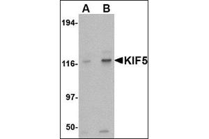 Western blot analysis of KIF5 in K562 cell lysate with this product at (A) 0. (KIF5A antibody  (Center))
