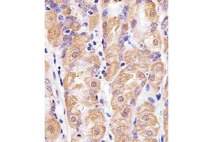 Immunohistochemical analysis of paraffin-embedded H. (TXN antibody  (C-Term))