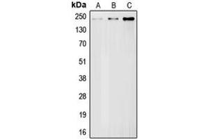 Western blot analysis of BRCA1 expression in HeLa (A), mouse liver (B), rat liver (C) whole cell lysates. (BRCA1 antibody  (Center))