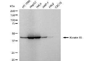Western blotting analysis using Keratin 18 antibody (ABIN7799175).