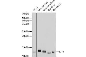 Western blot analysis of extracts of various cell lines, using IGF1 antibody (ABIN1682184, ABIN3015345, ABIN3015346 and ABIN7101347) at 1:1000 dilution. (IGF1 antibody)