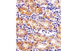 (ABIN6242877 and ABIN6578324) staining SLC22A2 in human stomach tissue sections by Immunohistochemistry (IHC-P - paraformaldehyde-fixed, paraffin-embedded sections).