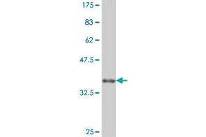 Western Blot detection against Immunogen (38. (RAPGEF3 antibody  (AA 772-881))