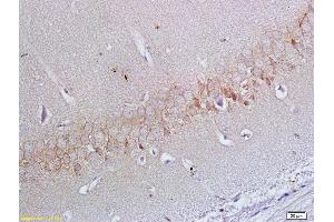 Formalin-fixed and paraffin embedded rat brain labeled with Anti-ApoER2 Polyclonal Antibody, Unconjugated (ABIN719426) at 1:200 followed by conjugation to the secondary antibody and DAB staining (LRP8 antibody  (AA 851-963))