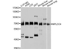 Western blot analysis of extracts of various cell lines, using NPLOC4 antibody (ABIN4904565) at 1:3000 dilution. (NPLOC4 antibody)