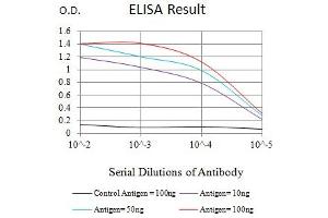 Black line: Control Antigen (100 ng),Purple line: Antigen (10 ng), Blue line: Antigen (50 ng), Red line:Antigen (100 ng) (Mesothelin antibody  (AA 296-606))