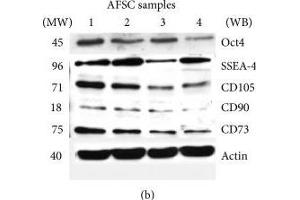 Effect of donor heterogeneity on stem cells markers. (CD73 antibody)