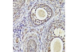 Immunohistochemistry (IHC) image for anti-Activating Transcription Factor 5 (ATF5) antibody (ABIN7265407)