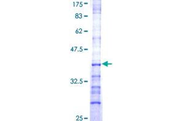GHRH Protein (AA 21-108) (GST tag)
