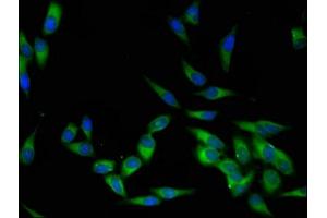 Immunofluorescent analysis of Hela cells using ABIN7174038 at dilution of 1:100 and Alexa Fluor 488-congugated AffiniPure Goat Anti-Rabbit IgG(H+L) (LCK antibody  (AA 1-539))
