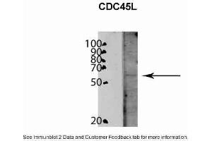 WB Suggested Anti-CDC45L Antibody Titration: 0. (CDC45 antibody  (C-Term))