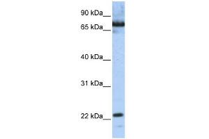 WB Suggested Anti-SCAND1 Antibody Titration:  0. (SCAND1 antibody  (N-Term))