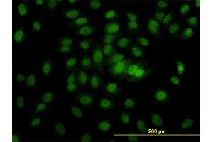 Immunofluorescence of monoclonal antibody to CSE1L on HeLa cell. (Exportin 2 antibody  (AA 872-971))