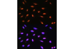 Immunofluorescence analysis of U2OS cells using LYAR Rabbit pAb  at dilution of 1:100. (LYAR antibody  (AA 10-160))