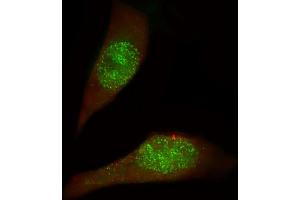 Immunofluorescent analysis of 4 % paraformaldehyde-fixed, 0. (USP27X antibody  (AA 1-30))