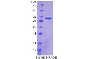 SDS-PAGE (SDS) image for Fibroblast Activation Protein, alpha (FAP) (AA 523-760) protein (His tag) (ABIN1878598)