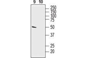 anti-Solute Carrier Family 35, Member G1 (SLC35G1) (AA 209-223), (Extracellular) antibody