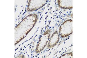 Immunohistochemistry of paraffin-embedded human stomach using TTBK2 antibody (ABIN6131392, ABIN6149666, ABIN6149669 and ABIN6223523) at dilution of 1:200 (40x lens).