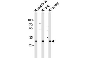 Western blot analysis of lysates from human placenta, human lung, human kidney tissue lysate (from left to right), using SOD3 Antibody (C-term) (ABIN6242639 and ABIN6577764). (SOD3 antibody  (C-Term))