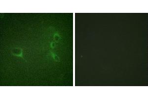 P-peptide - +Immunofluorescence analysis of NIH/3T3 cells, using Bcr (Phospho-Tyr360) antibody. (BCR antibody  (pTyr360))