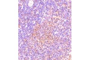 Immunohistochemistry of TANK in rat spleen tissue with this product at 10 μg/ml. (TANK antibody  (C-Term))