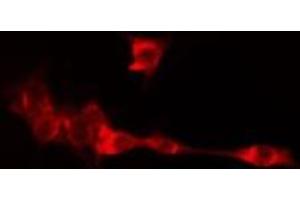ABIN6275082 staining LOVO cells by IF/ICC. (DNAI2 antibody  (N-Term))