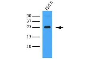 The Cell lysates (40ug) were resolved by SDS-PAGE, transferred to PVDF membrane and probed with anti-human MINCLE antibody (1:1000). (CLEC4E antibody)