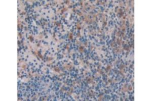 Figure. (Caspase 4 antibody  (AA 81-266))