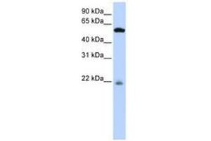 Image no. 1 for anti-Peptidase M20 Domain Containing 2 (PM20D2) (AA 252-301) antibody (ABIN6741115) (PM20D2 antibody  (AA 252-301))