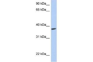 RTDR1 antibody used at 1 ug/ml to detect target protein.