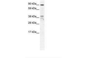 ZC3H7B antibody  (AA 136-185)
