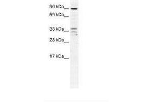 Image no. 1 for anti-Zinc Finger CCCH-Type Containing 7B (ZC3H7B) (AA 136-185) antibody (ABIN202958) (ZC3H7B antibody  (AA 136-185))