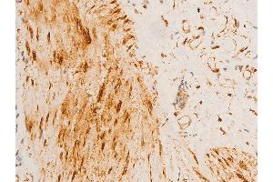 Immunohistochemistry (IHC) image for anti-Heat Shock Protein, alpha-Crystallin-Related, B6 (HSPB6) (pSer16) antibody (ABIN6256161)