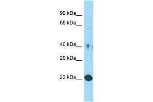Host: Rabbit Target Name: C11orf34 Sample Type: HT1080 Whole Cell lysates Antibody Dilution: 1. (Plet1 antibody  (Middle Region))
