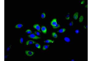 Immunofluorescent analysis of A549 cells using ABIN7161071 at dilution of 1:100 and Alexa Fluor 488-congugated AffiniPure Goat Anti-Rabbit IgG(H+L) (NCR1 antibody  (AA 121-230))