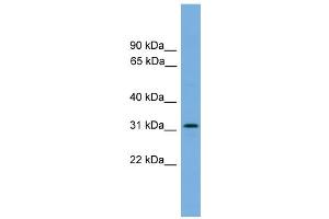 WB Suggested Anti-DAPP1  Antibody Titration: 0. (DAPP1 antibody  (Middle Region))