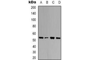 Western blot analysis of Ubiquilin 4 expression in HEK293T (A), K562 (B), NIH3T3 (C), mouse brain (D) whole cell lysates. (UBQLN4 antibody)