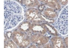 Detection of EEF1a1 in Human Kidney Tissue using Polyclonal Antibody to Eukaryotic Translation Elongation Factor 1 Alpha 1 (EEF1a1) (eEF1A1 antibody  (AA 1-241))