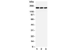 Western blot testing of LRP5 antibody and Lane 1:  rat liver (LRP5 antibody  (C-Term))