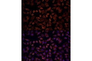 Immunofluorescence analysis of L929 cells using [KO Validated] KRAS Rabbit pAb (ABIN6132168, ABIN6143000, ABIN6143001 and ABIN6216439) at dilution of 100 (40x lens). (K-RAS antibody  (AA 30-188))