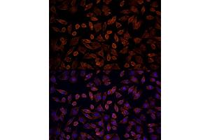 Immunofluorescence analysis of L929 cells using [KO Validated] KRAS Rabbit pAb (ABIN6132168, ABIN6143000, ABIN6143001 and ABIN6216439) at dilution of 100 (40x lens). (K-RAS antibody  (AA 30-188))