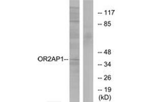 Western blot analysis of extracts from Jurkat cells, using OR2AP1 Antibody.
