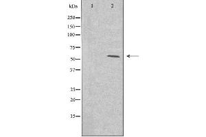 Western blot analysis of extracts from HeLa cells using Cytochrome P450 2A13 antibody. (CYP2A13 antibody)