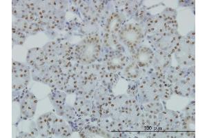 Immunoperoxidase of monoclonal antibody to SMC1L1 on formalin-fixed paraffin-embedded human salivary gland.