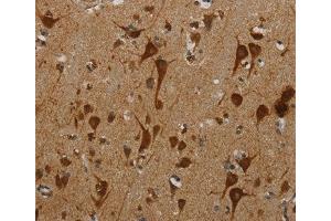 Immunohistochemical analysis of paraffin-embedded Human brain tissue using at dilution 1/40.