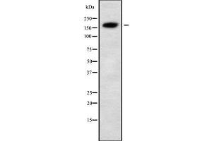 Western blot analysis of ALS2 using MCF7 whole cell lysates (ALS2 antibody  (N-Term))