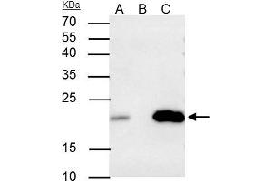 Immunoprecipitation (IP) image for anti-Caveolin 2 (CAV2) (N-Term) antibody (ABIN2856589)