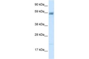 Western Blotting (WB) image for anti-Amiloride-Sensitive Cation Channel 3 (ACCN3) antibody (ABIN2461108) (ASIC3 antibody)