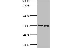 Western blot All lanes: Estrogen sulfotransferase antibody at 7 μg/mL Lane 1: Mouse lung tissue Lane 2: Mouse liver tissue Secondary Goat polyclonal to rabbit IgG at 1/10000 dilution Predicted band size: 35, 30 kDa Observed band size: 35 kDa (SULT1E1 antibody  (AA 140-294))