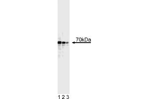 Western Blotting (WB) image for anti-Tumor Protein P73 (TP73) (AA 380-367) antibody (ABIN967629)